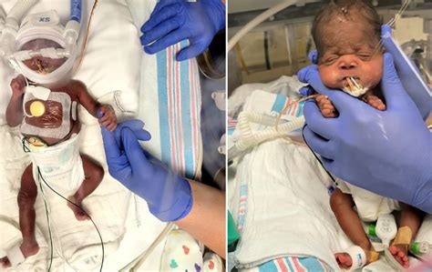 Twins who were the 'size of pop cans' at birth go home after nearly 140 days in the hospital